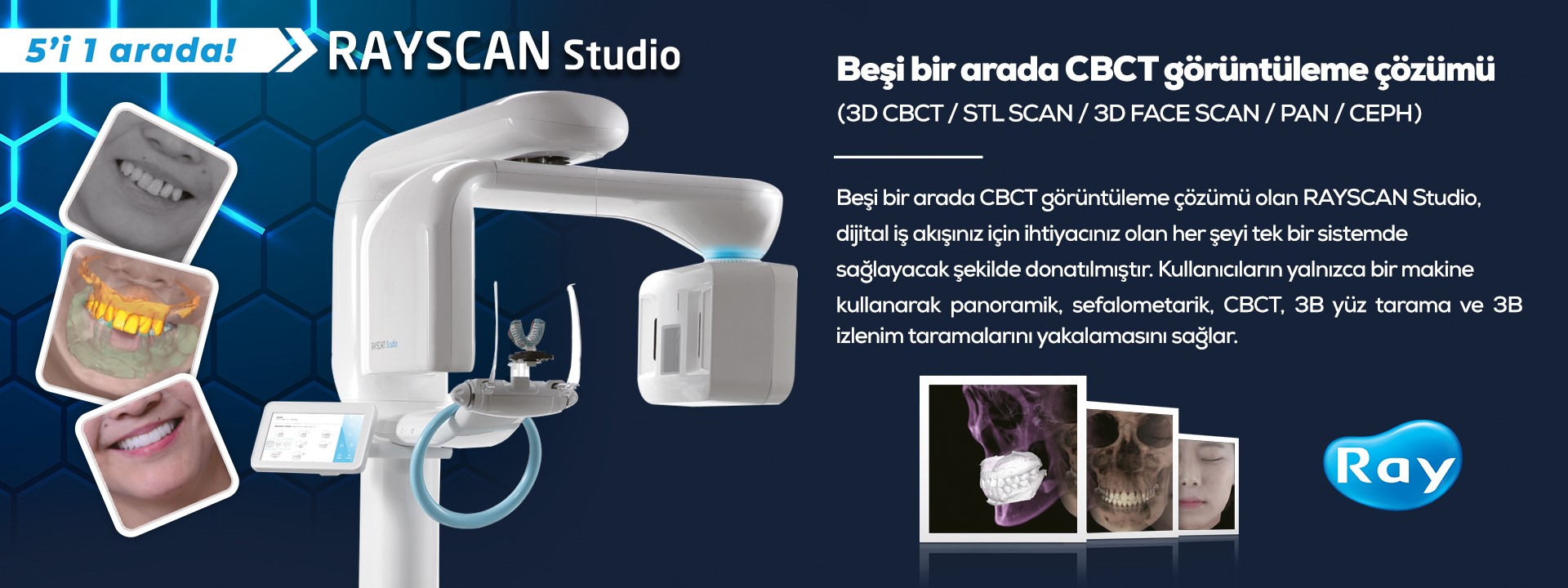 Rayscan Studio